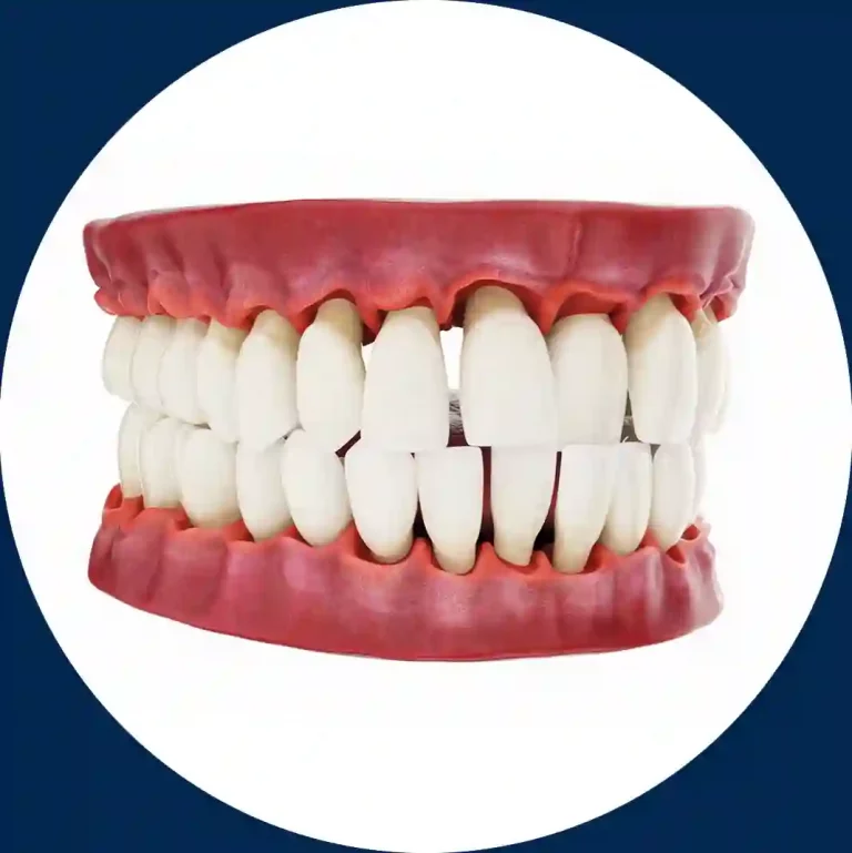 Imagen portada video Enfermedad Periodontal DentalVid