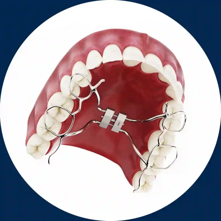 Imagen portada video Expansor de Paladar DentalVid