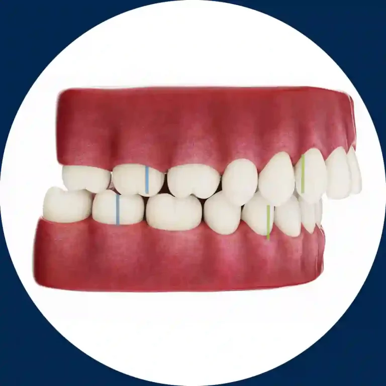 Imagen portada video Maloclusion DentalVid