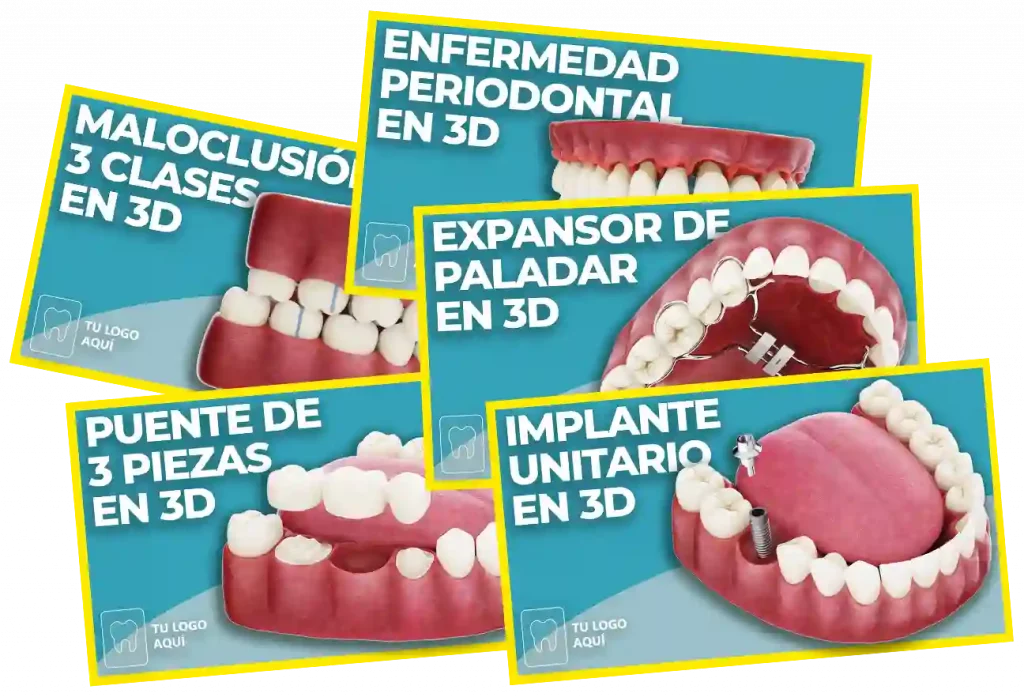 Paquetes y precios DentalVid Videos odontologia 3D video dental clinica transparente cuadrado