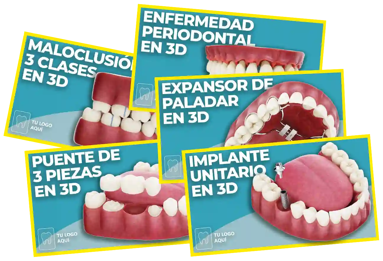 Paquetes y Precios de vídeos odontológicos en 3D